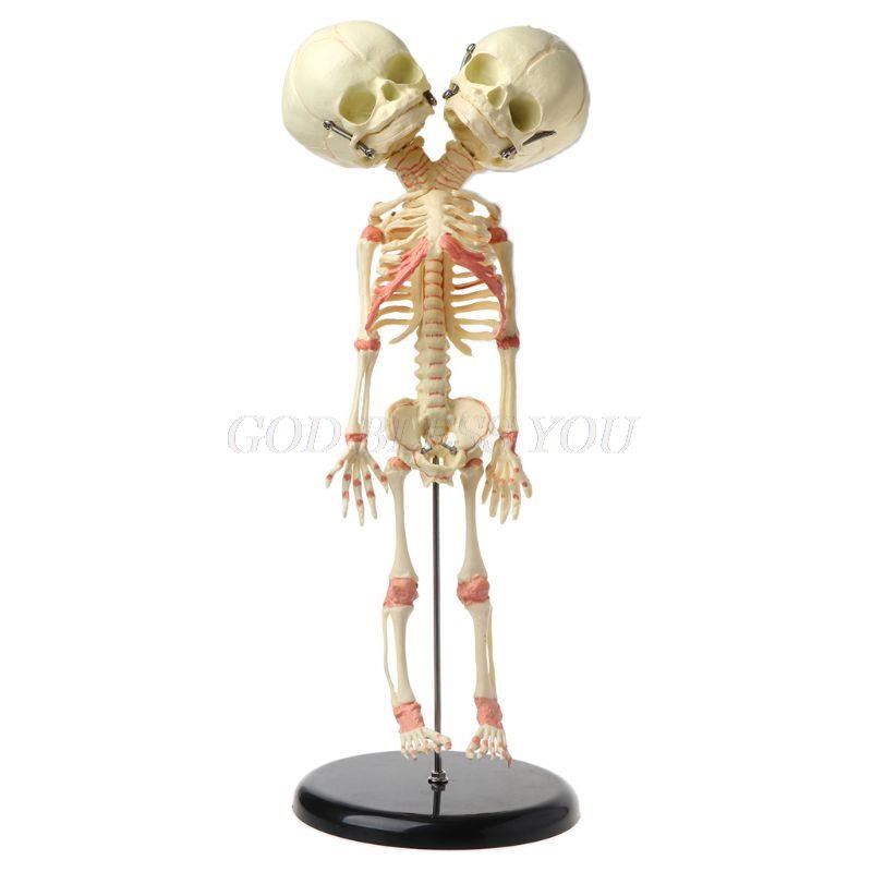 37cm Human Double Head Baby Skull Skeleton Anatomy Brain Display Study Teaching Anatomical Model