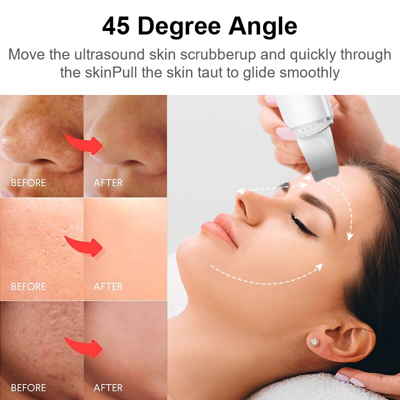 Ultrasonic Skin Scrubber Vibration Face Spatula Blackhead Remover Facial Scrubber Shovel Clean Cavitation Peeling Facial Lifting