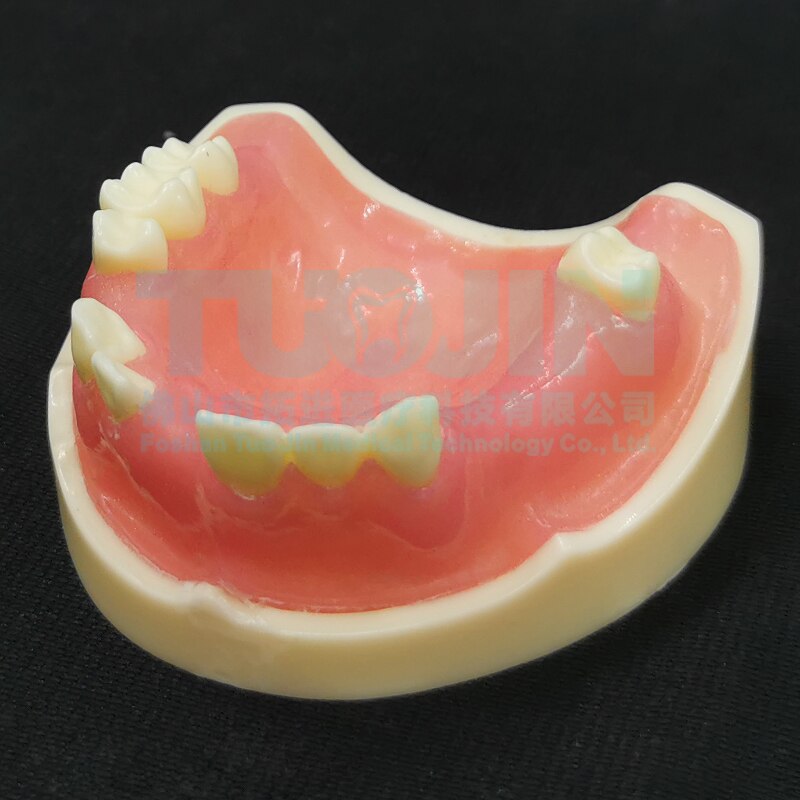 Dental Harz Zähne Tipodont Modell Für Dental Techniker Praxis Lehre Gum Zähne Kiefer Modell Zahnmedizin Ausrüstung: TYPE 14