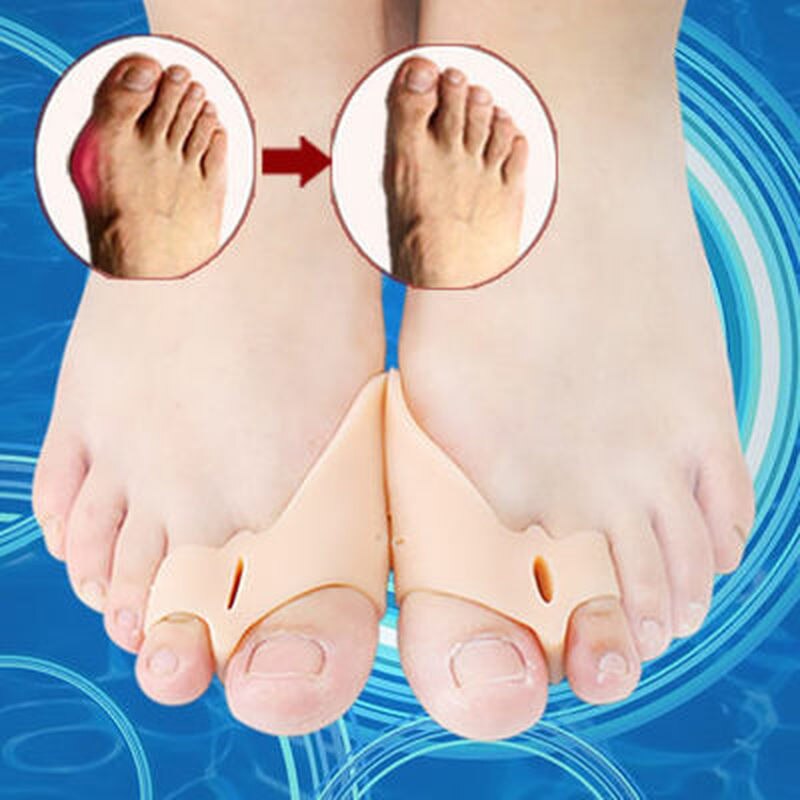 soin orthopédique des pieds, 2 pièces = 1 paire, attelle spéciale, protection du pouce en Gel de Silicone, séparateur d'orteils, redresseur, outils de soins