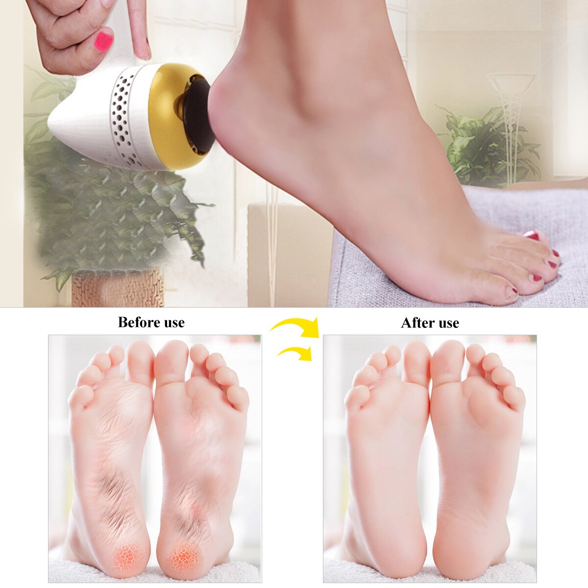 Electronic Foot File Rechargeable Vacuum Adsorption Pedicure Machine Multifunction Electric Remove Calluses Foot Care Tool