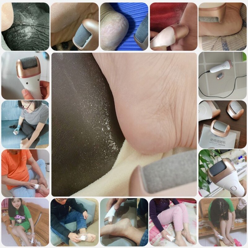 Electric foot callus rechargeable foot file, with 3 grinding heads waterproof X9FE