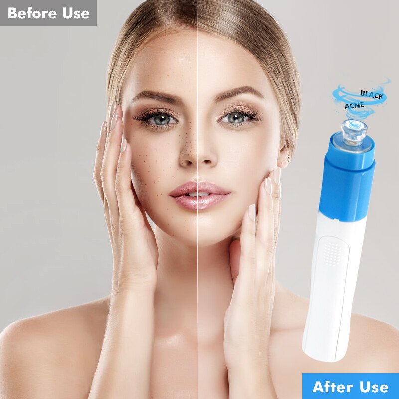 Blackhead Remover Vacuum Acne Remover Pore Cleaner Skin Facial Cleanser Kit Exfoliating Cleansing Facial Beauty tool