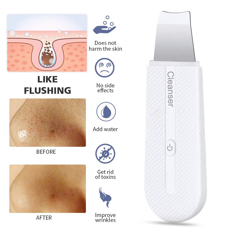 Ultrasonic Skin Scrubber Facial Spatula Blackhead Remover Pore Cleaner Deep Cleansing Beauty Face Lifting: Red