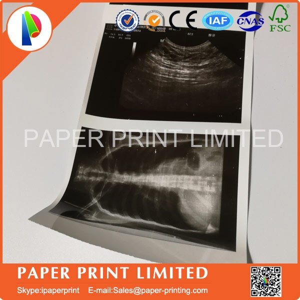 5X ROLLEN UPP-110S Für drucker 110mm * 20 m Upp 110 s SONO COPATIBLE Ultraschall Thermische Papier rolle