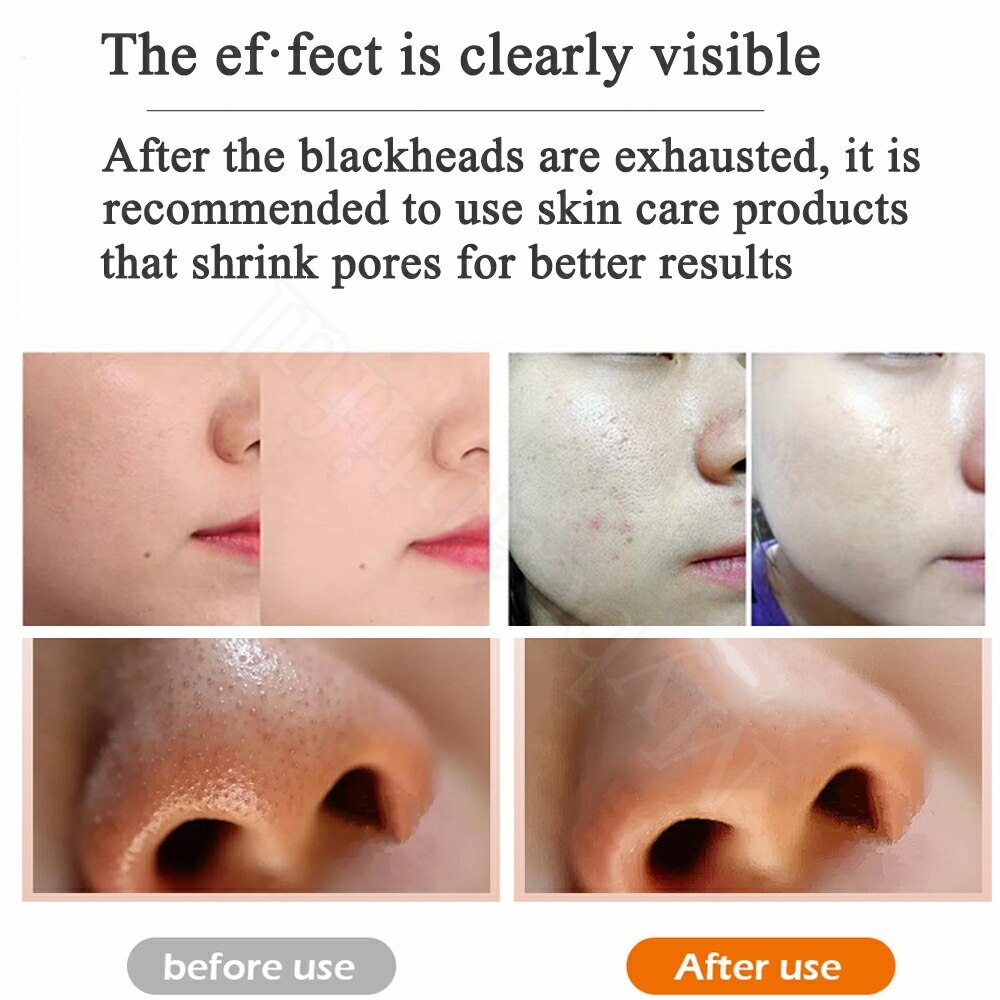 Diamond Microdermabrasion Machine For Personal Home Use Skin Exfoliato Anti Wrinkle Blackhead Remover Face Care Beauty Device