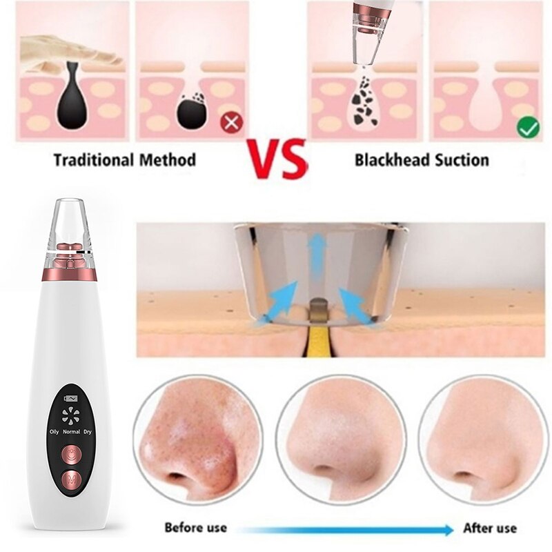 Blackhead Remover Face Deep Nose Pore Acne Cleaner Pimple Removal Vacuum Suction Deep Facial Clean Diamond Beauty Skin Care Tool