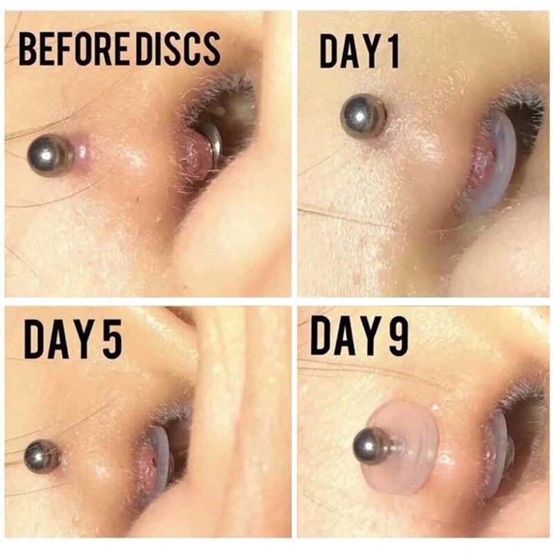 10 stykker piercing helende silikoneskiver til bagsiden af øreringene gennemsigtige skivepuder til fastgørelse af øreringe