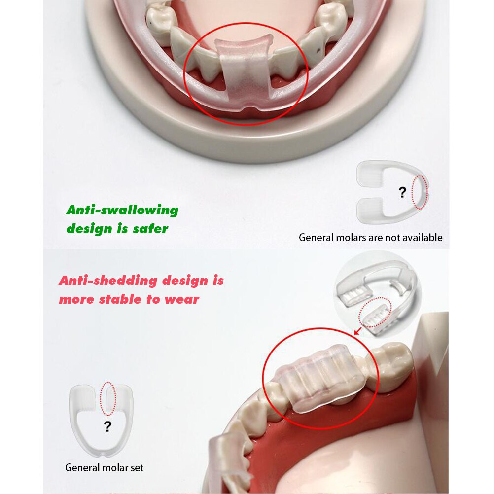 Professionele Tandheelkundige Night Guard Tanden Slijpen Protector Stopt Tandenknarsen Bruxisme Night Sleep Aid Gereedschap