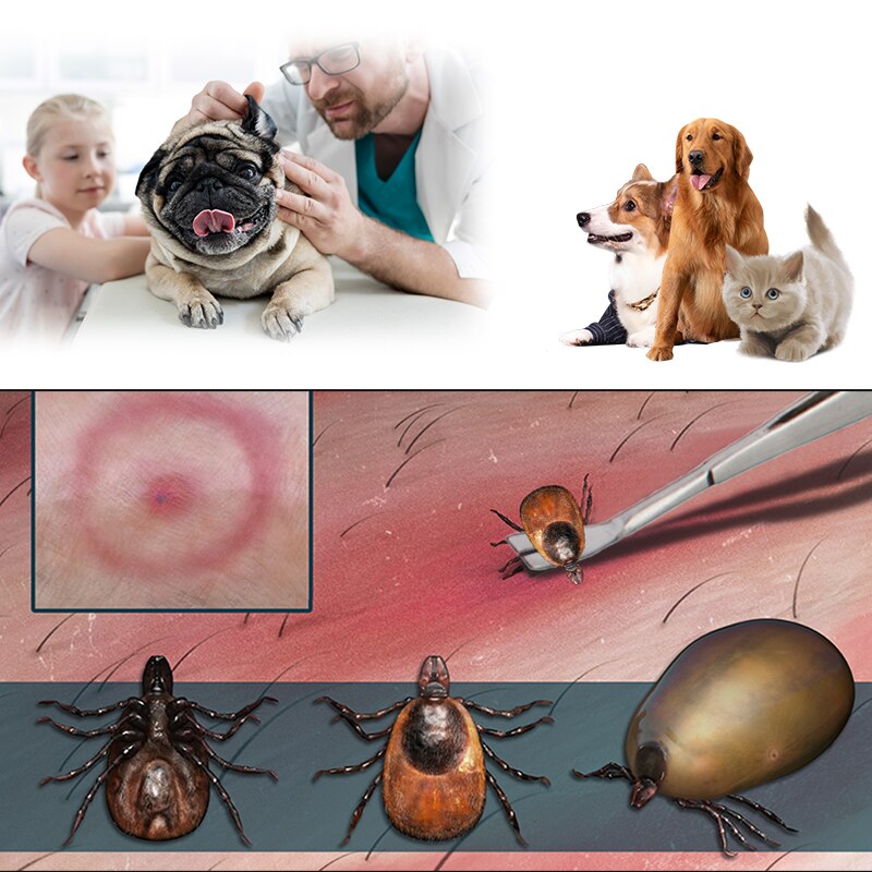 2 In 1 Stainless Steel Tick Tweezers Quick Tick Removal Tool for Cat Dog People Pet Supplies Dog Tick Removal