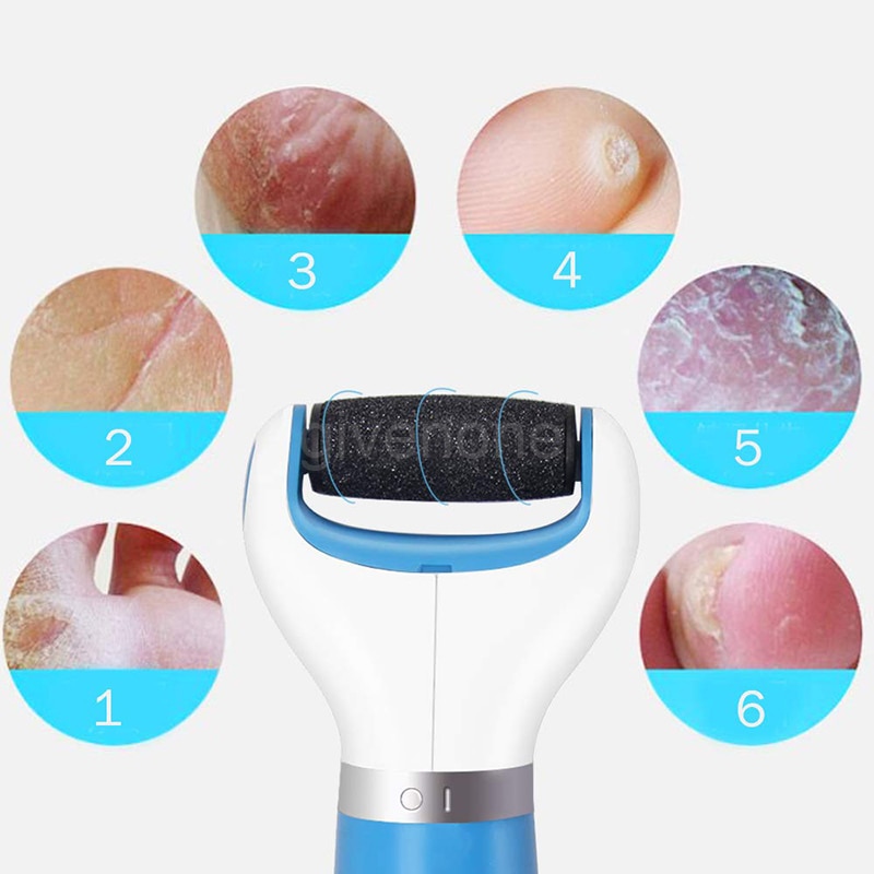 Draagbare Elektrische Voet Bestand Usb Pedicure Machine Voet Reparatie Machine Harde Droge Dode Cuticula Huid Remover Thuis Voet Care Tool