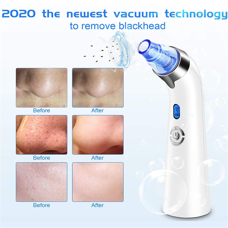 Facial Vacuum Blackhead Whitehead Remover Electric Face Nose Cleaner T Zone Pore Acne Pimple Removal Skin Care Beauty Clean Tool