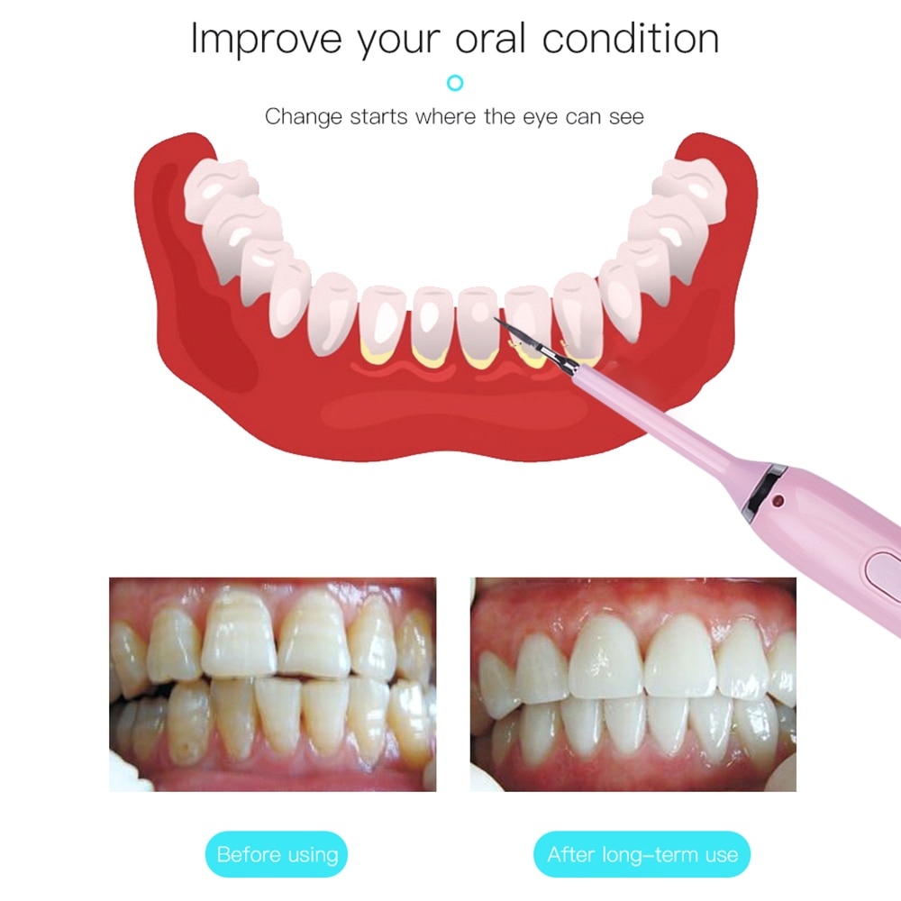 Powerful Ultrasonic Electric Toothbrush USB Rechargeable Sonic Waterproof Whitening Dental calculus remover Dental care