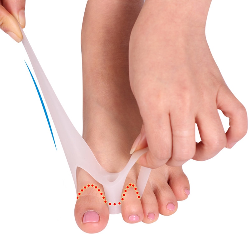 2Stck/1 Paar Doppel See Zehe Separator Hallux Valgus Ballen Korrektor Orthesen Fuß Knochen Daumen Erzähler Korrektor