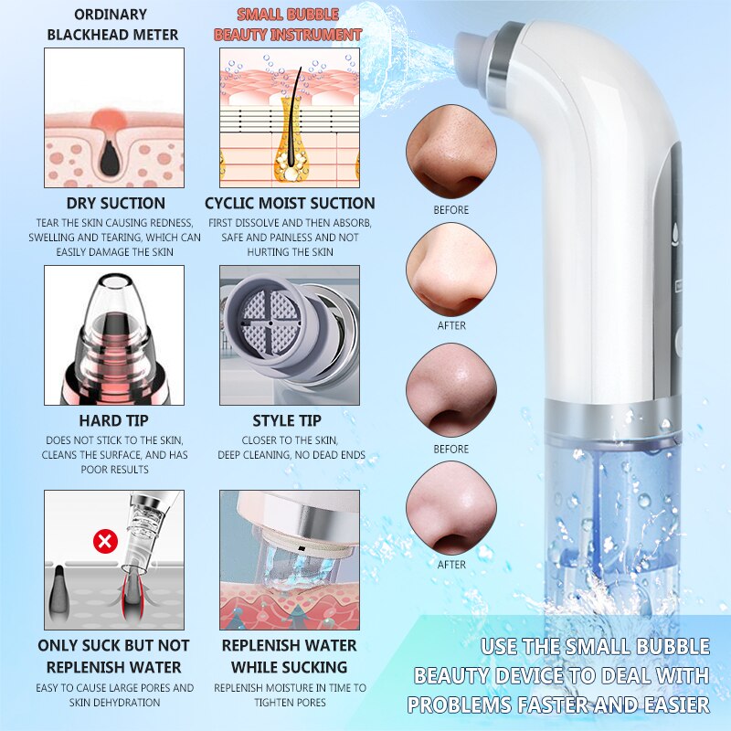 Electric Small Bubble Blackhead Remover Vacuum Black Dots Deep Face Cleansing Acne Pimple Remover Pore Remover Skin Cleaner