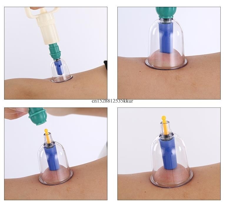 Aparatura robić terapii próżniowej medyczne zasysanie próżniowe kubki robić masażu masaż puszki robić słoików na masaż twarzy