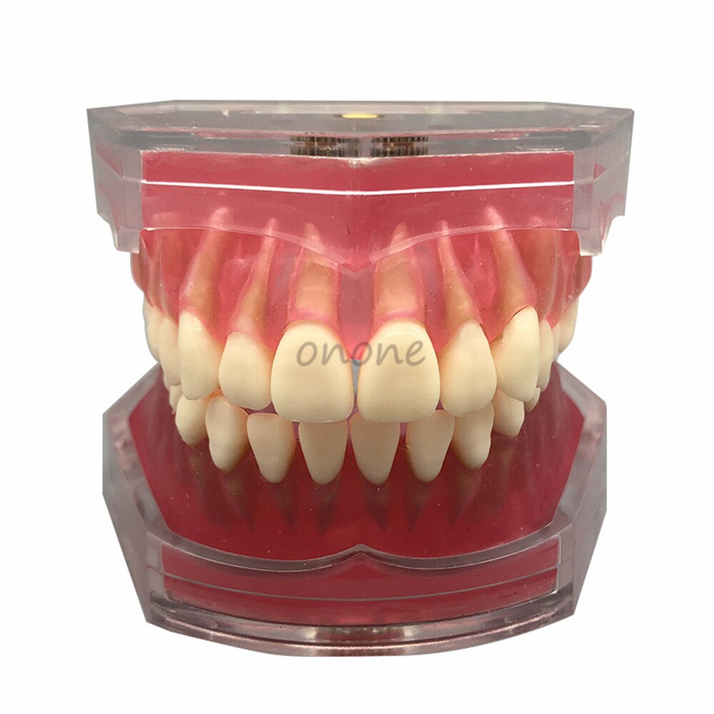 Dental Standard Model with Removable Teeth Dental Study Teach Teeth Model