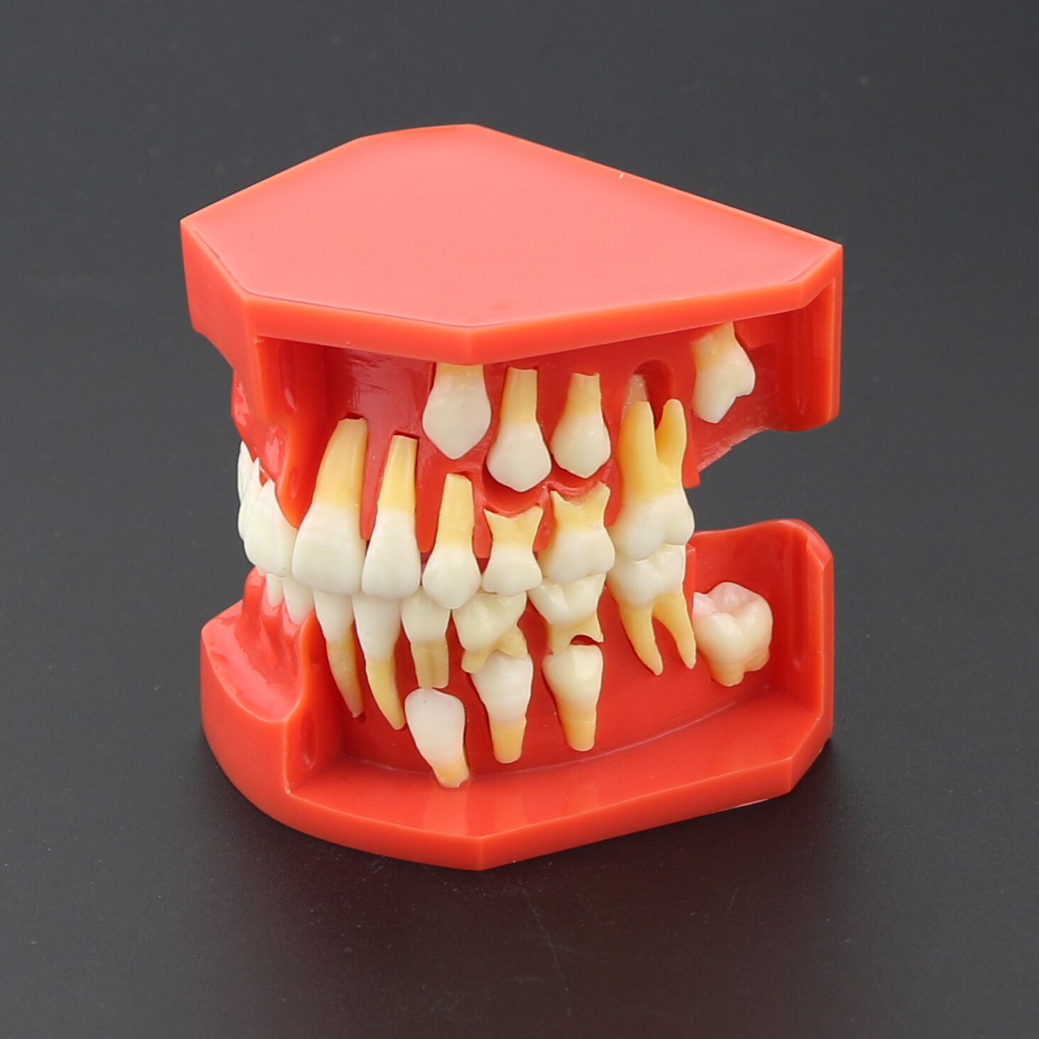 Dental Teeth Model M7013 Typodont Pediatric Development 9-12 Years Constant Teeth Grow Replace Demo Anatomy Teaching Study