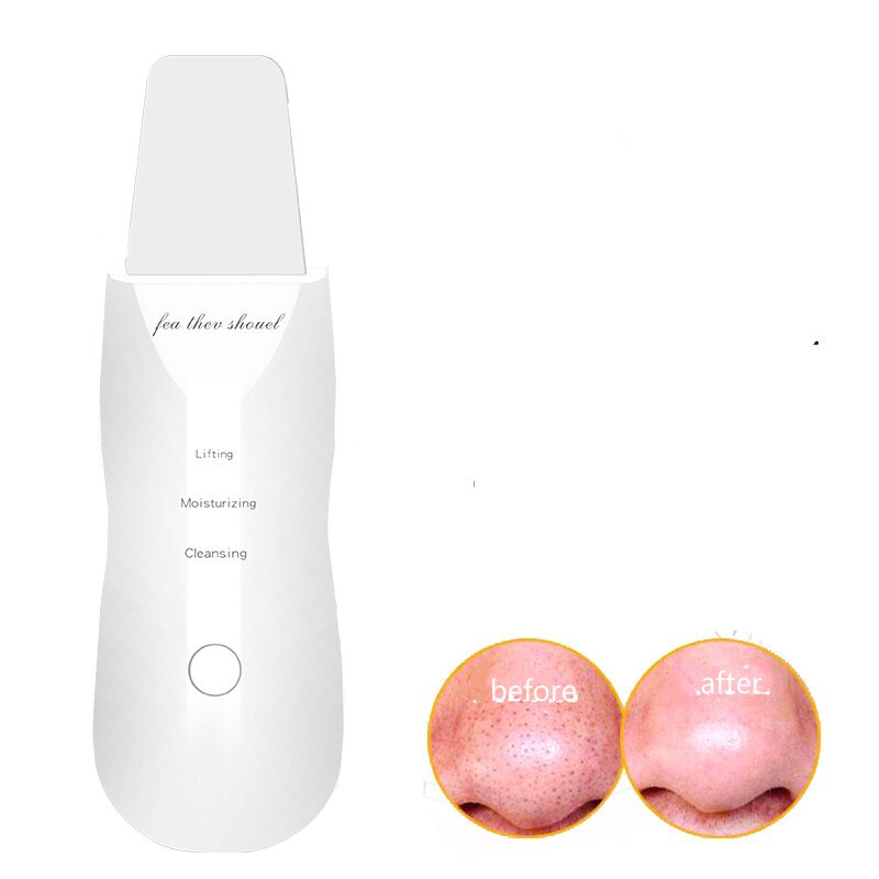 Rechargeable Ultrasonic Skin Scrubber Nutrient lead-in Ultrasound face massage Facial Cleaner Peeling Vibration Blackhead Remova: not frog