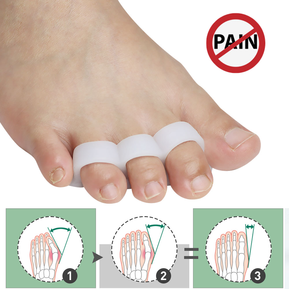 Pexmen 2Pcs/Bag Gel Toe Separators Toe Spacers Straightener for Bunions Hammertoe Overlapping and Claw Toes Reduce Foot Pain