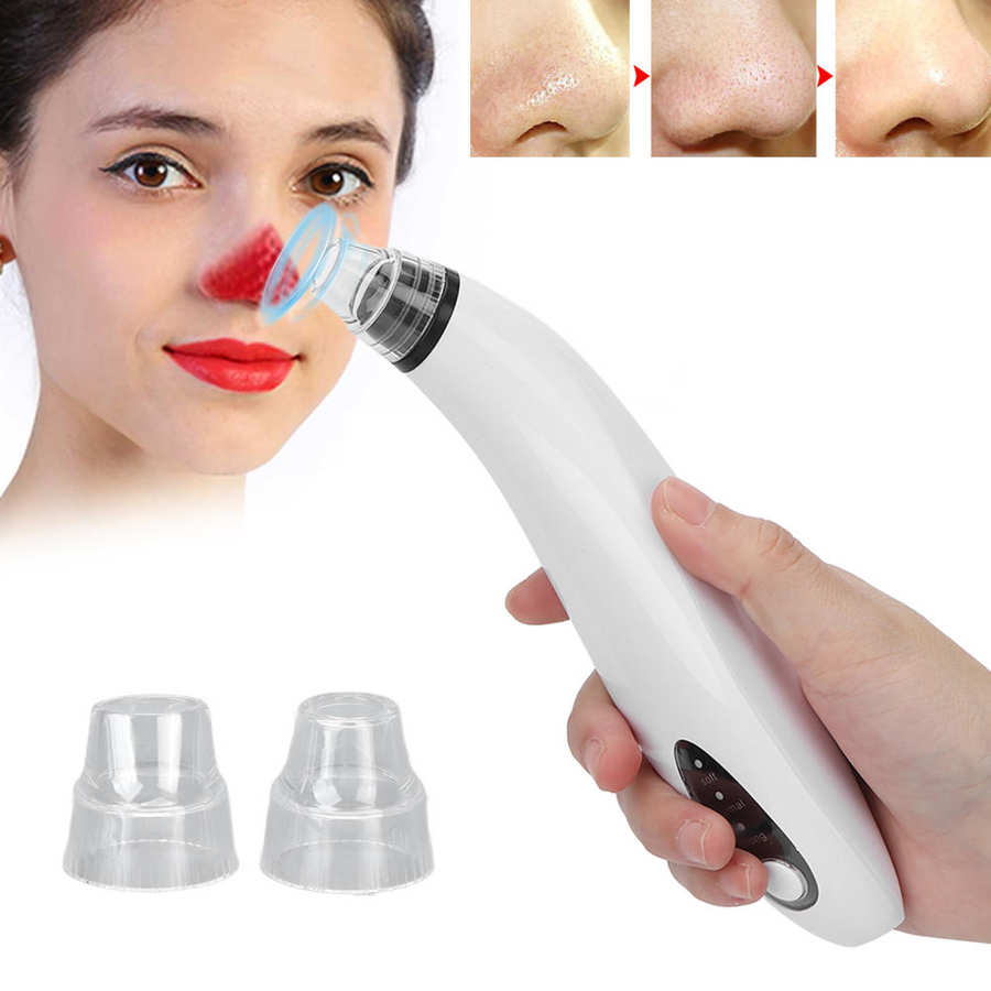 Blackhead Removal Tool Mild Blackhead Vacuum Cleaner Replaceable Probes Large Suction Power for Beauty Salon