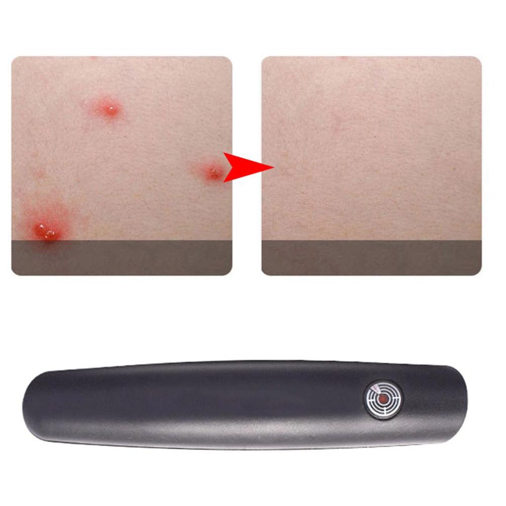 Tragbare Infrarot Puls Entlasten Juckreiz stift Sommer Schnell Sicher Kinder Insekt Moskito Beißen Lindern Schwellungen stift