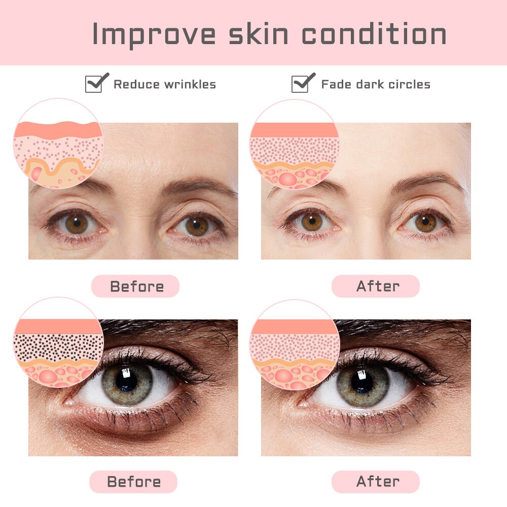 Masajeador de ojos LED con luz roja, dispositivo de belleza para estiramiento de ojos y cara de fotones, EMS RF, eliminación de ojeras y arrugas, máquina de masaje de vibración