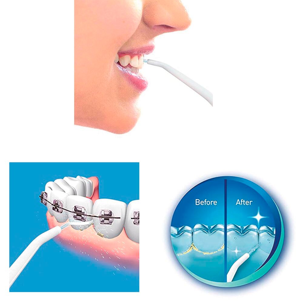 Irrigador bucal con sistema de propulsión a chorro, dientes y encías sanas, limpieza dental, práctico, eficaz, , agua