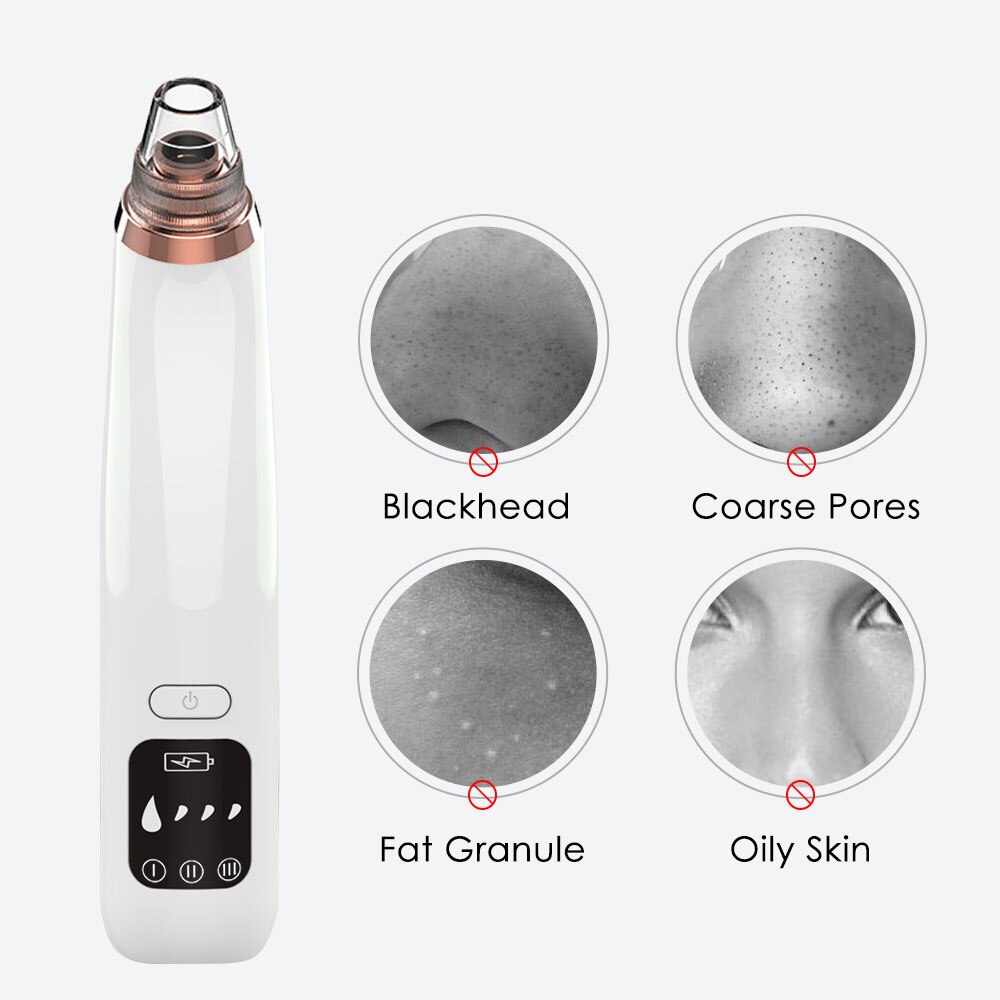 Blackhead removal Pore cleaning Electric blackhead removal acne Vacuum suction Deep facial cleansing Beauty Skin cleansing tools