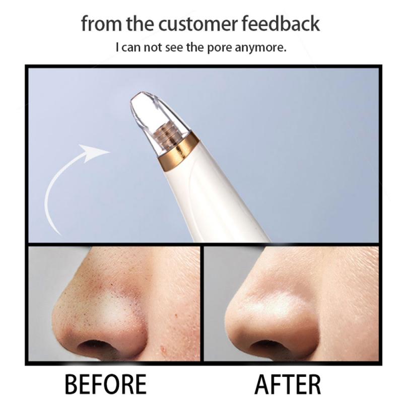 Blackhead Remover Skin Care Pore Vacuum Acne Removal Vacuum Suction Tool Facial Dermabrasion Machine Face Clean Blemish Removers