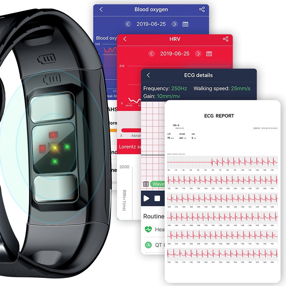 AVATTO ECG PPG HRV Smart Bracelet IP68 Waterproof Blood Pressure Oxygen Heart Rate Monitor Sport Tracker Men Women Wrist Band