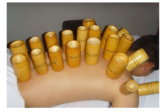 10/20 Pcs Gekookt Bamboe Massage Cupping Set Verkoolde Bamboe Traditionele Vacuüm Cupping Acupunctuur Fire Therapie