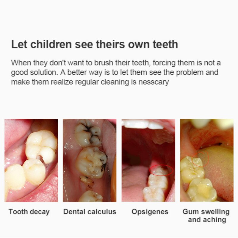 Professione Senza Fili Wifi USB Intra Orale Dentale Telecamera Intraorale Dentista Dispositivo ah CONDOTTO LA Luce di video in tempo Reale di Controllo Dei Denti Strumento