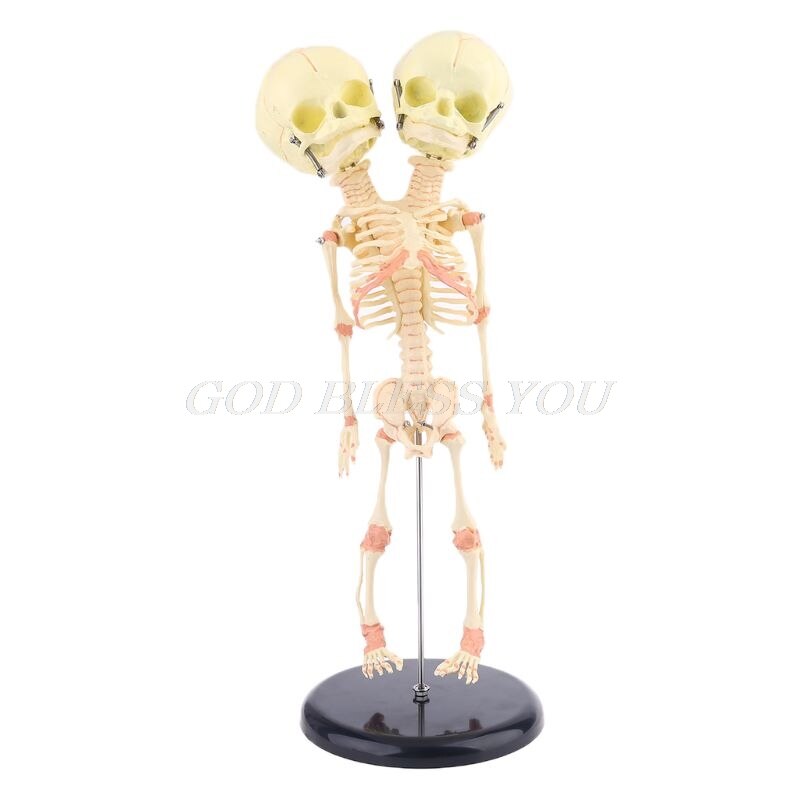 Human Double Head Baby Skull Research Model Skeleton Anatomical Brain Anatomy Teaching Study Display