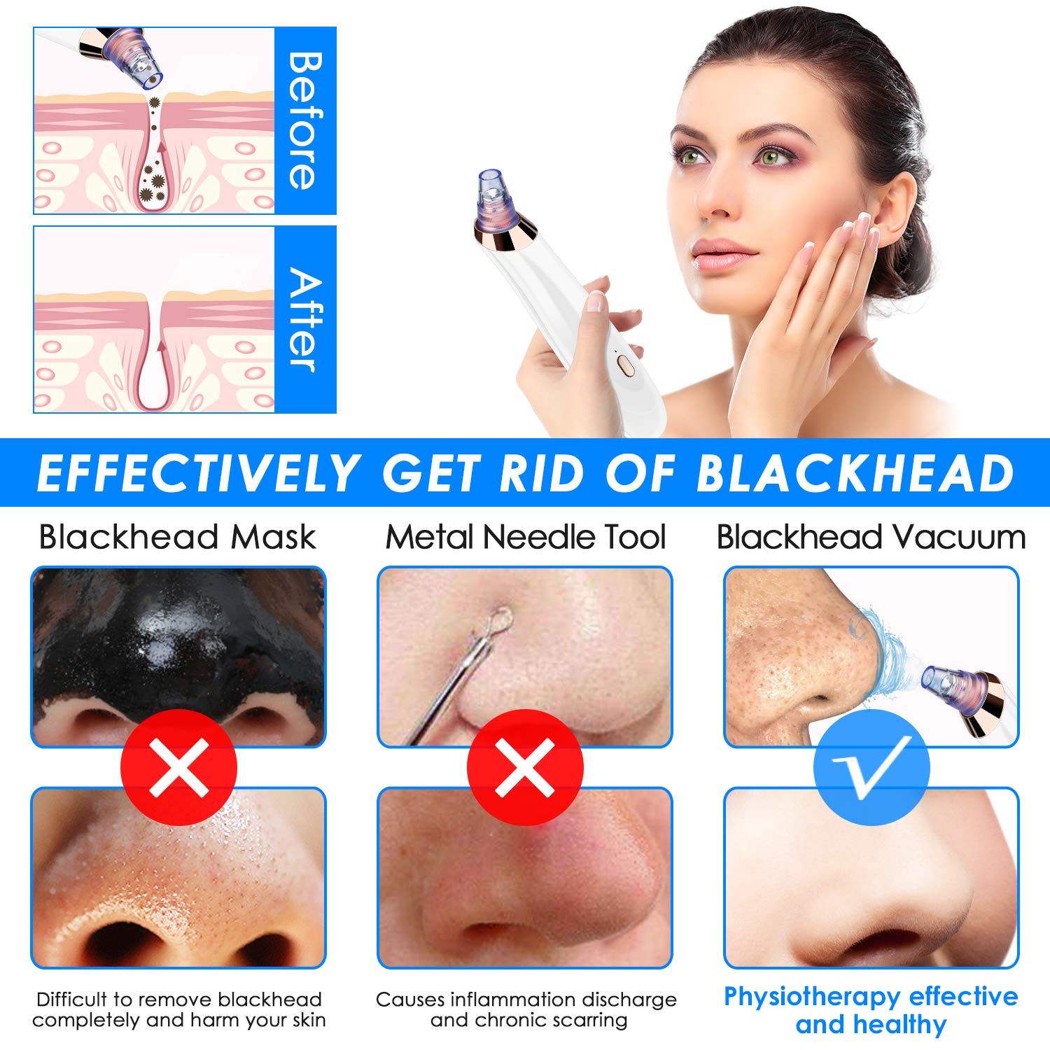 Blackhead remover Pore Vacuum 5 in 1 Blackhead Vacuum Tools Kit Electric Comedo Suction Device with 3 Adjustable Strength