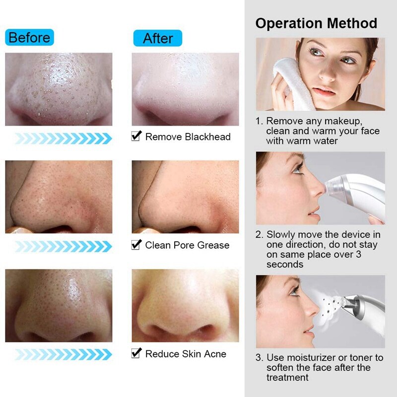 Electric Acne Extractor Remover Vacuum Blackhead Remover Face Skin Cleaner Facial Acne Cleaner Beauty Tool