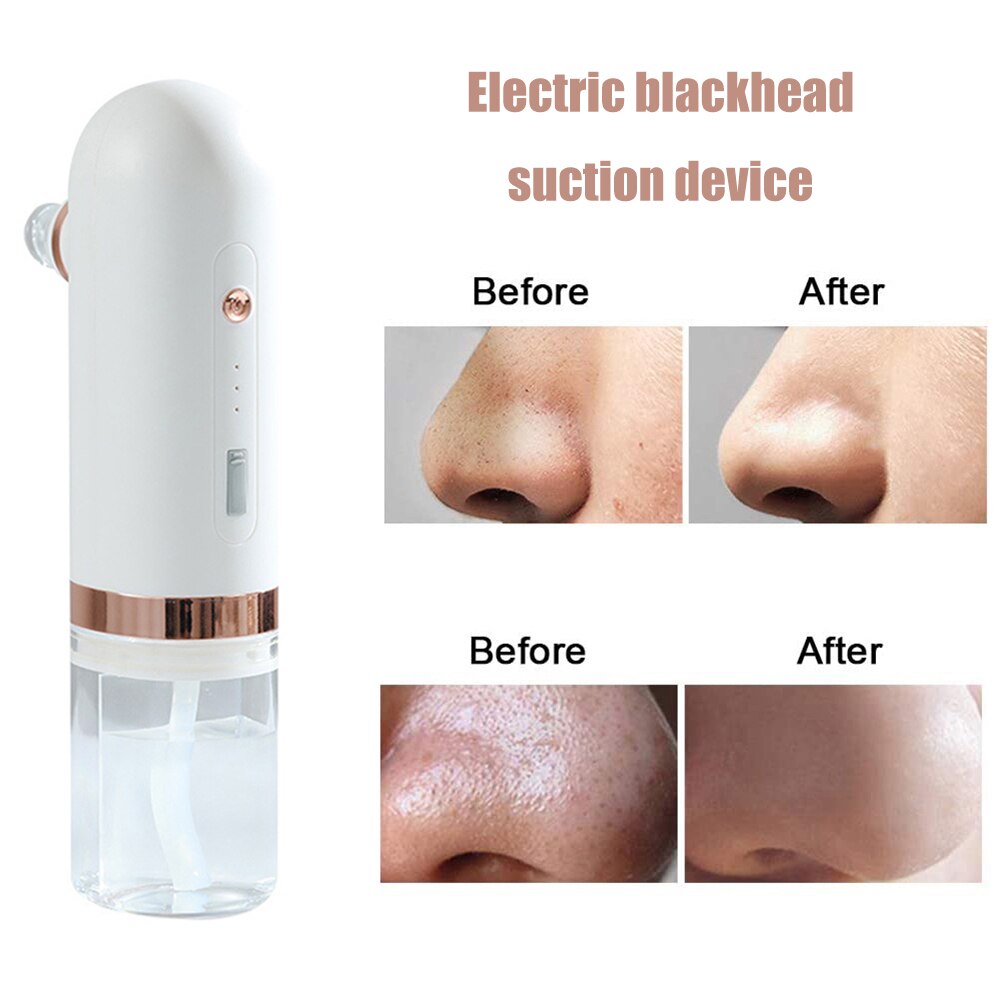 Household Small Bubble Cleaner With Water Cycle Cleaning Vacuum Blackhead Acne Remover Facial Electric Pore Deep Cleansing Tool