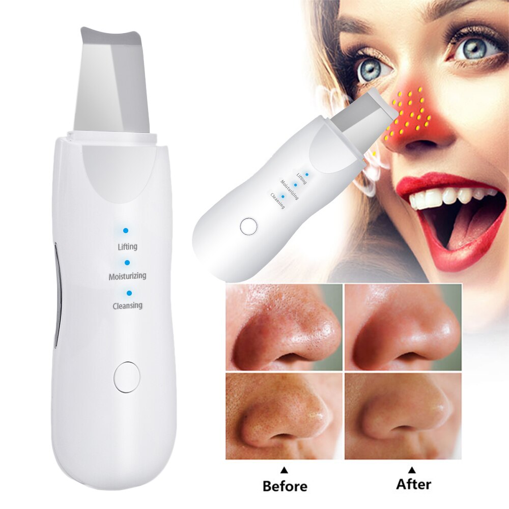Appareil électrique de gommage de la peau, dissolvant de points noirs, spatule de Peeling du visage, Machine de Lifting du visage, amincissant, masseur à rouleau