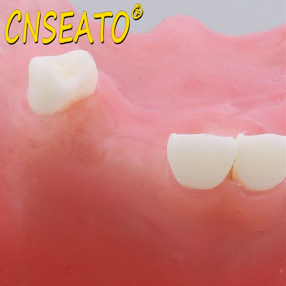 Dental Teeth Model Sinus Lift Practice Maxillary Bone Dentistry Tooth Models Dentist Teaching Demonstration Implant Simulator