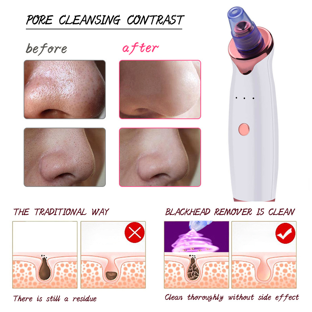 Ultrasonic Skin Scrubber Vibration Face Spatula Blackhead Remover Facial Scrubber Shovel Clean Cavitation Peeling Facial Lifting