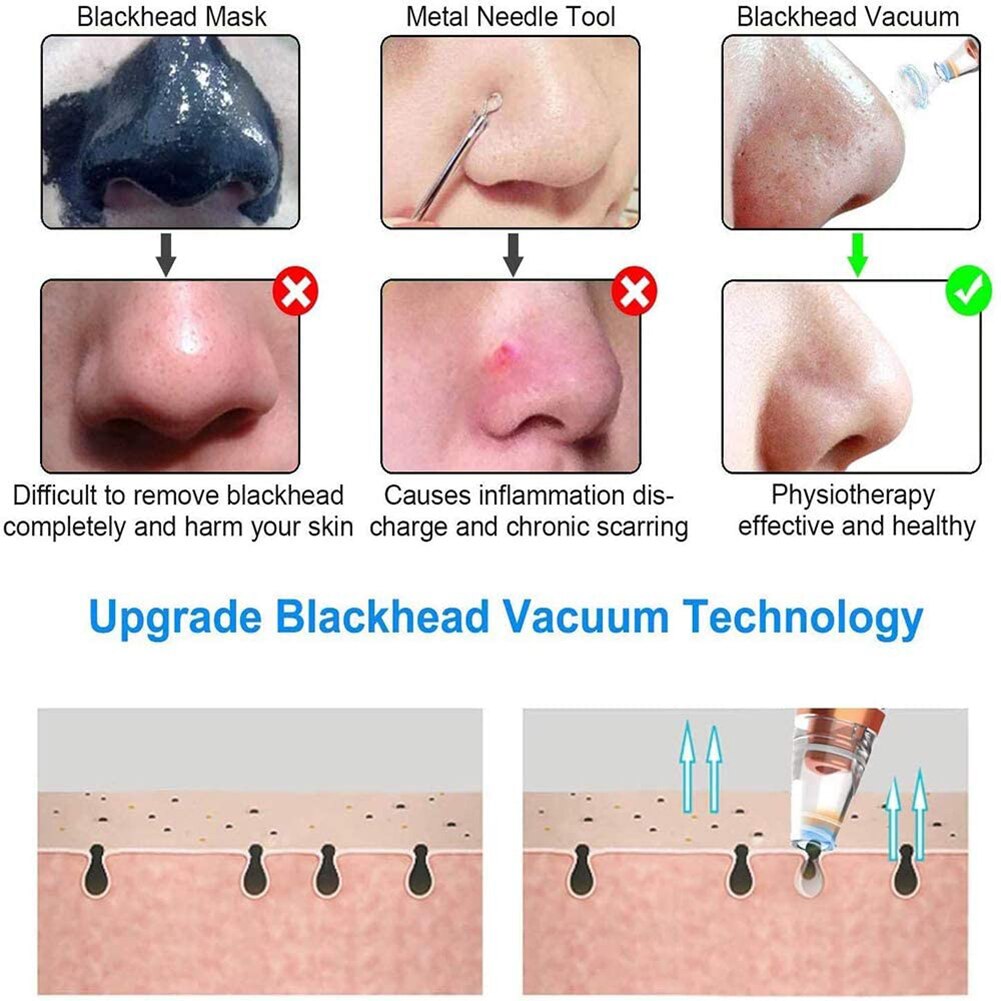 Blackhead Remover Point Noir Electric Acne Vacuum Extractor Suction Tool Black Spots Pore Cleaner Skin Care Facial Clean Machine