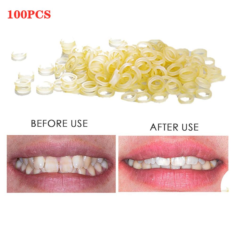 100pcs Dental Materials Disposable Rubber Ring 6.35mm Ligation Ring