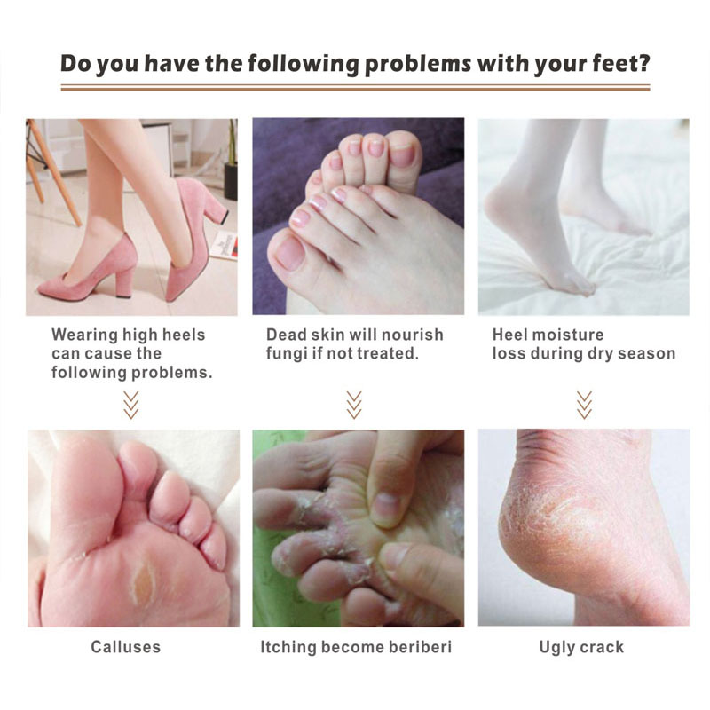 Electric Heel Callus Remover 2000MAh USB Recharging Foot File Care Tool Feet Hard Dead Skin Removal Pedicure Device