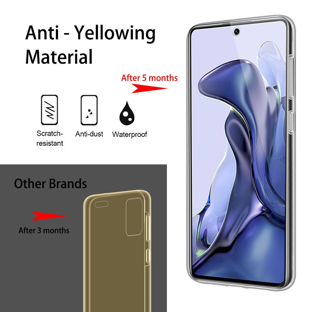 360 Cover Op Voor Xiaomi 11 T Pro 6.67Inch Case Soft Tpu Dubbelzijdig Transparant Coque Voor Xiaomi 11 T Xiomi Xaomi Mi11 T Mi 11Tpro