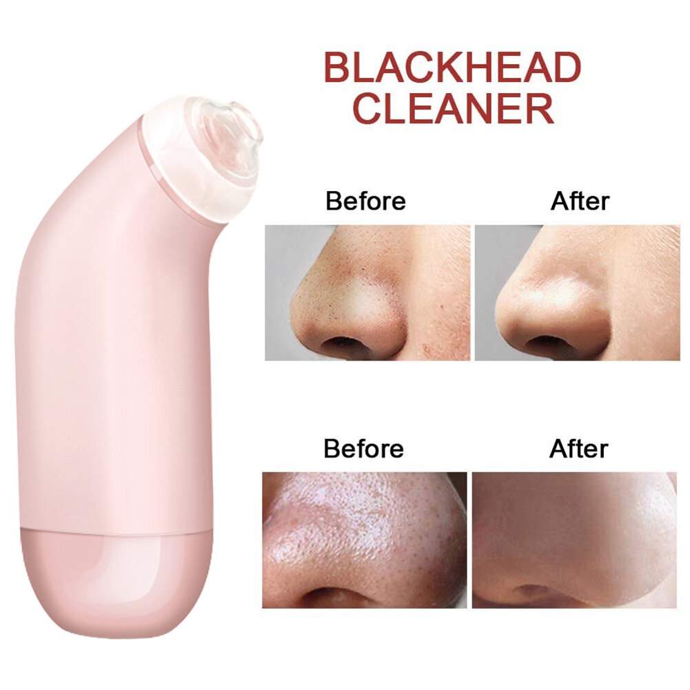 Blackhead Remover Instrument Electric Black Dot Suction Device Beauty Tool
