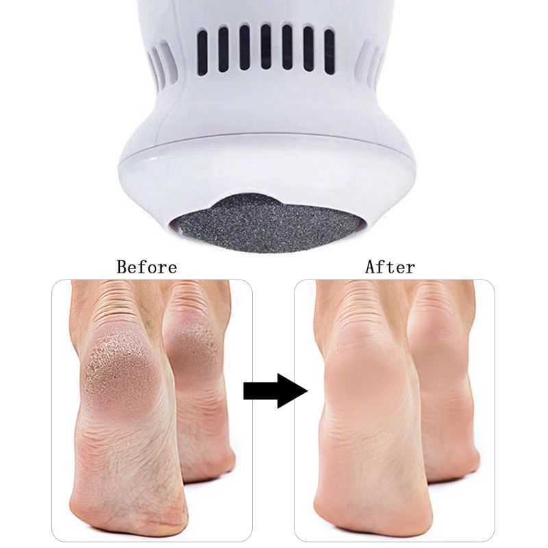 Electric Callus Eliminator, Pedicure Tools for Removing Hard Skin and Dead Skin