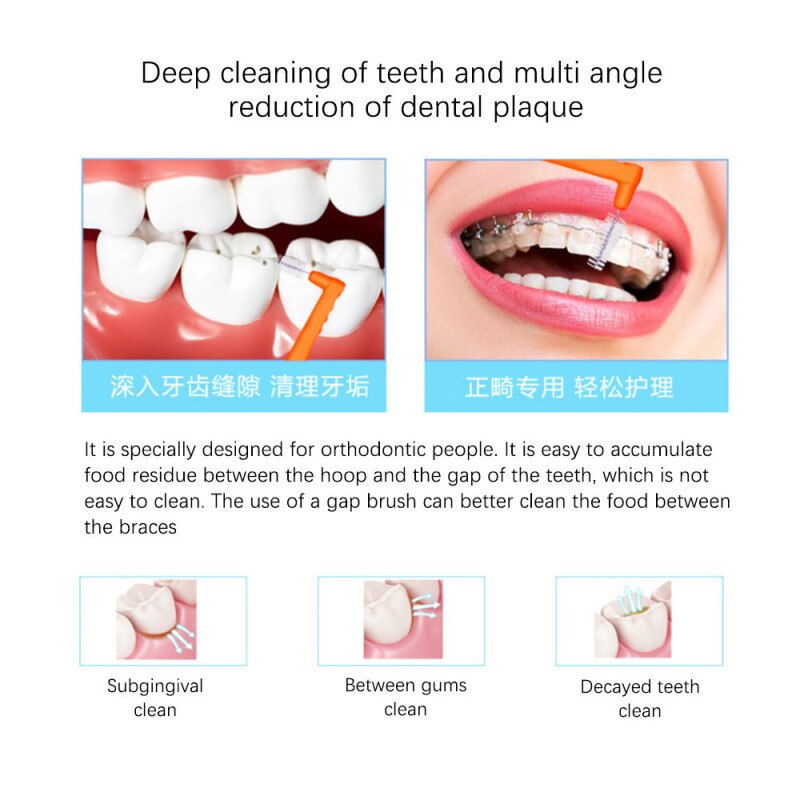 20 Stks/doos L Vorm 0.6-1.5Mm Volwassenen Rager Push-Pull Tandenstoker Interdentale Tandenborstel Tooth Pick voor Orale Reiniging