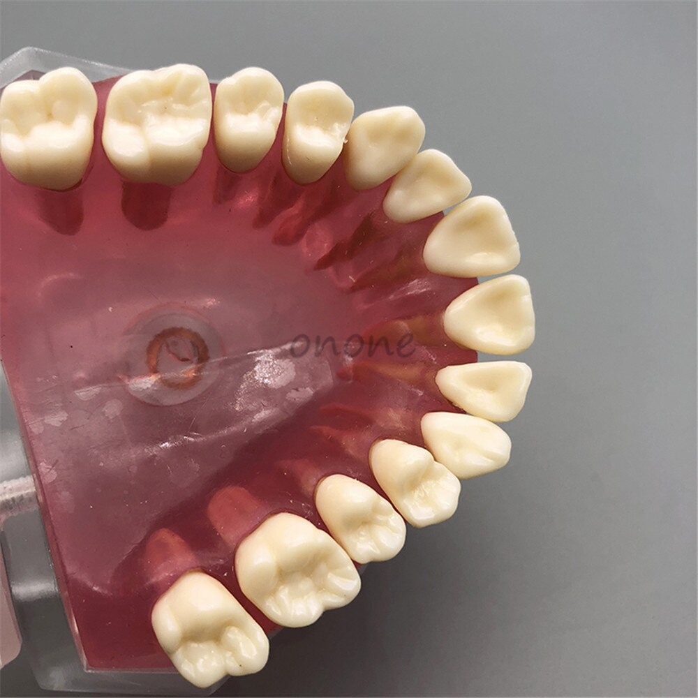 Dental Standard Model with Removable Teeth Dental Study Teach Teeth Model