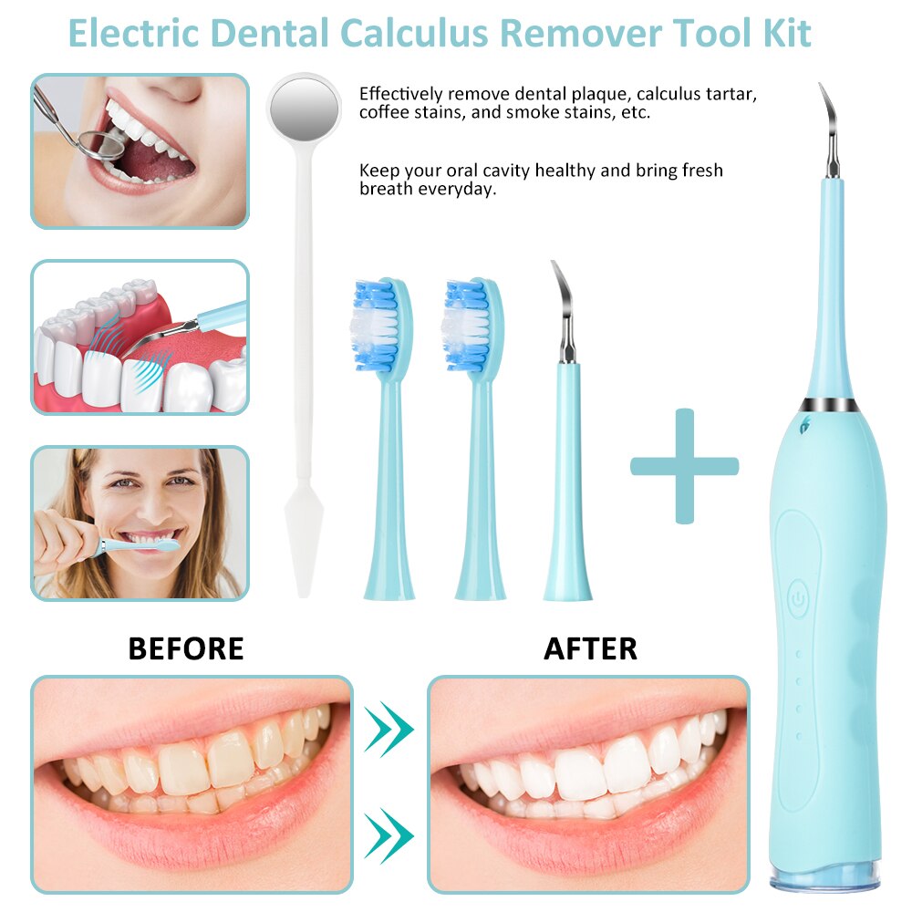 Elektrische Ultra Schall- Schall- Zahn Scaler Zahn Zahnstein Entferner Reiniger Hohe Frequenz Zahn Flecken Zahnstein Werkzeug Bleichen Zähne Neue
