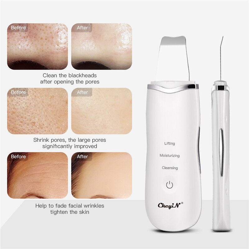 Ems Mesotherapie Rf Led Photon Draai Facial Massager + Ultrasone Huid Scrubber Diepe Gezicht Cleaning Pore Cleaner Schoonheid Machine